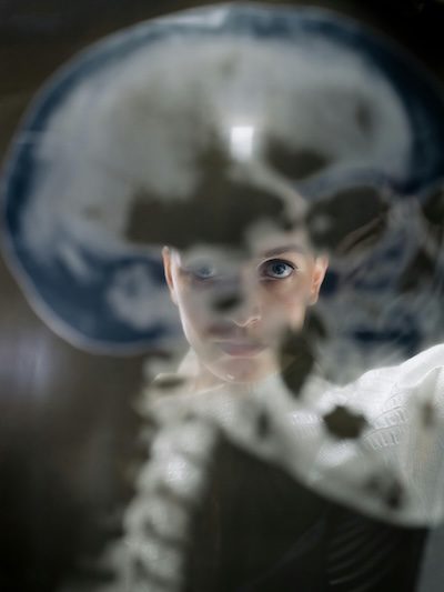Person Holding an X-Ray Film of Skull and Spine